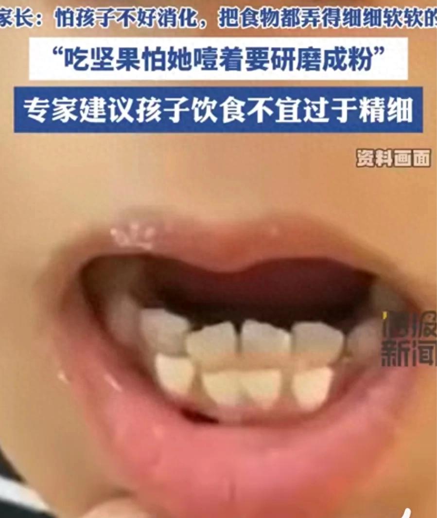 6歲女童吃得太精細長出雙排牙